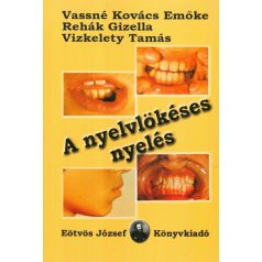 A nyelvlökéses nyelés