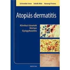 Atopiás dermatitis